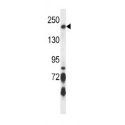 Fanconi Anemia Group J Protein (BRIP1) Antibody
