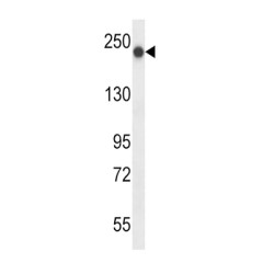 Fanconi Anemia Group J Protein (BRIP1) Antibody