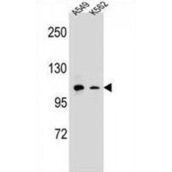 Integrin Alpha M / CD11b (ITGAM) Antibody