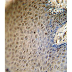 Sterol Regulatory Element-Binding Protein 2 (SREBF2) Antibody