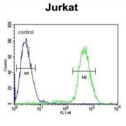 Protein Phosphatase 1 Regulatory Subunit 3A (PPP1R3A) Antibody