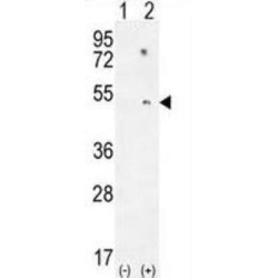 Serum Paraoxonase / Arylesterase 1 (PON1) Antibody