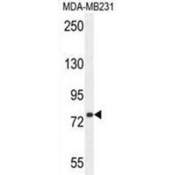 Sorbin And SH3 Domain Containing Protein 1 (SORBS1) Antibody