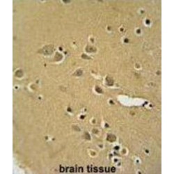 Alpha-Amylase 2B (AMY2B) Antibody