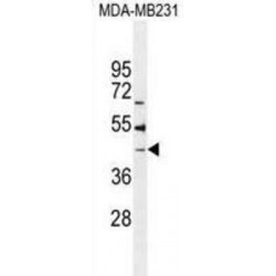 Beta-1,4-Galactosyltransferase 6 (B4GALT6) Antibody