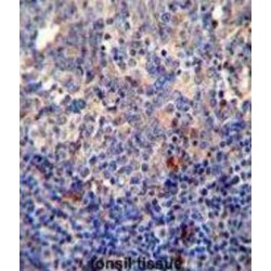 B-Cell Lymphoma/leukemia 10 (BCL10) Antibody