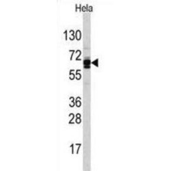 Ubiquitin Carboxyl-Terminal Hydrolase 21 (USP21) Antibody