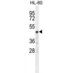 Carbohydrate Sulfotransferase 2 (CHST2) Antibody
