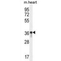 Glycerol-3-Phosphate Dehydrogenase 1 Like (GPD1L) Antibody