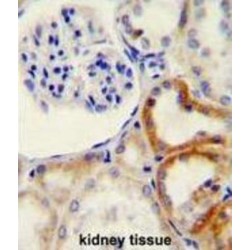 Hyaluronidase-2 (HYAL2) Antibody