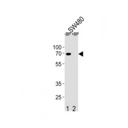 ETS Translocation Variant 5 (ETV5) Antibody