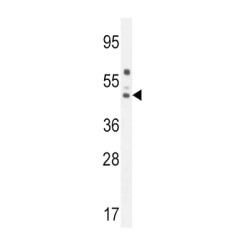 Corticosteroid Binding Globulin (SERPINA6) Antibody