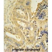 Tolloid-Like Protein 1 (TLL1) Antibody