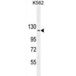 Rho GTPase-Activating Protein 17 (ARHGAP17) Antibody