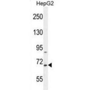 WB analysis of HepG2 cell lysates.