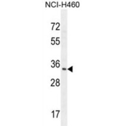 Ribonuclease T2 (RNT2) Antibody