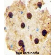 Ornithine Decarboxylase Antizyme 2 (OAZ2) Antibody