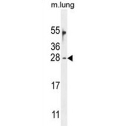 Ornithine Decarboxylase Antizyme 2 (OAZ2) Antibody