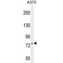 Ankyrin Repeat Domain-Containing Protein 44 (ANR44) Antibody