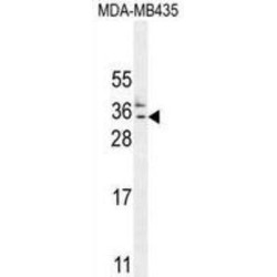 CK073 Antibody