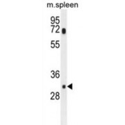 WB analysis of Mouse spleen tissue lysates (35 µg/lane), using MCAR1 Antibody.