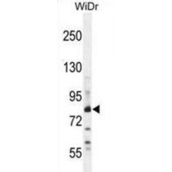 Zinc Finger Protein 180 (ZN180) Antibody