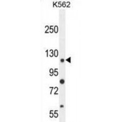 Ankyrin Repeat Domain-Containing Protein 52 (ANR52) Antibody