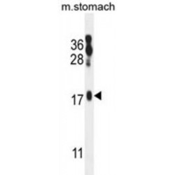 ORM1-Like Protein 2 (ORML2) Antibody