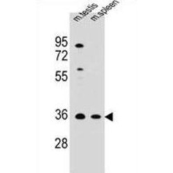 Ankyrin Repeat And SOCS Box Protein 17 (ASB17) Antibody