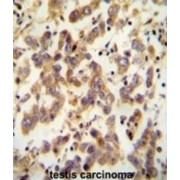 abx025936