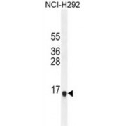 Sperm Associated Antigen 11A (SPAG11A) Antibody