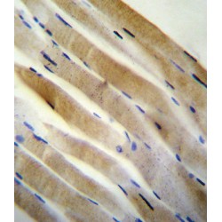 5'-AMP-Activated Protein Kinase Catalytic Subunit Alpha-2 (PRKAA2) Antibody
