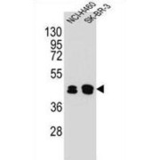 Keratin 80 (KRT80) Antibody