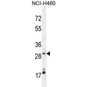 MAGI Family Member, X-Linked (MAGIX) Antibody