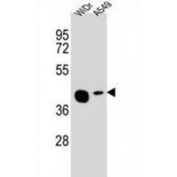 Acyl-Malonyl-Condensing Enzyme 1-Like Protein 2 (AMAC1L2) Antibody