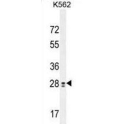 Testis-Expressed Protein 13B (TEX13B) Antibody