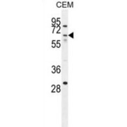 Zinc Finger Protein 674 (ZNF674) Antibody