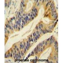 Solute Carrier Family 16 Member 11 (SLC16A11) Antibody