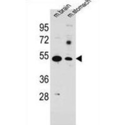 Solute Carrier Family 16 Member 11 (SLC16A11) Antibody