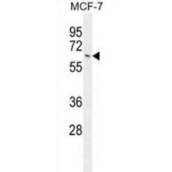 NTPase KAP Family P-Loop Domain-Containing Protein 1 (NKPD1) Antibody