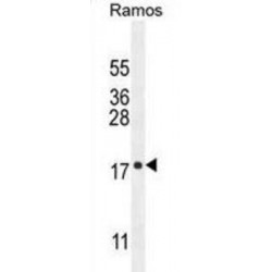 Chromosome 11 Open Reading Frame 53 (C11orf53) Antibody