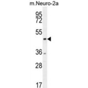 C-Terminal-Binding Protein 1 (CTBP1) Antibody
