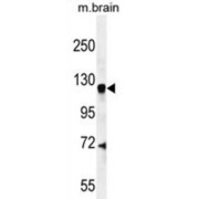 Centaurin-Gamma-1 (CENTG1) Antibody