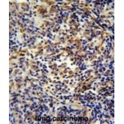 Caskin-2 (CASKIN2) Antibody