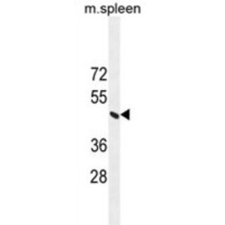 DNA Excision Repair Protein ERCC-8 (ERCC8) Antibody