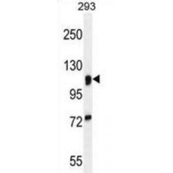 Alpha-Mannosidase 2 (MAN2A1) Antibody