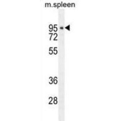 Denticleless Protein Homolog (DTL) Antibody