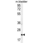 Achaete-Scute Family BHLH Transcription Factor 2 (ASCL2) Antibody