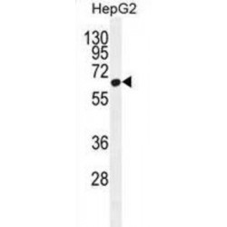 Zinc Finger CCCH Domain-Containing Protein 12A (ZC12A) Antibody