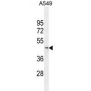 JmjC Domain-Containing Protein 5 (JMJD5) Antibody